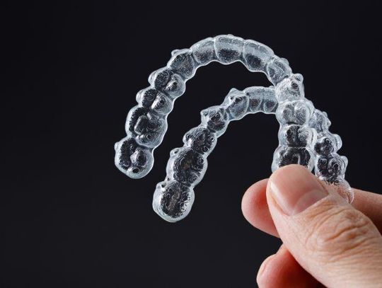 Aparaty ortodontyczne Invisalign – co można jeść w trakcie leczenia? Praktyczne wskazówki