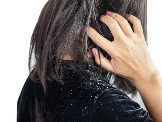 Nadwrażliwość skóry głowy – kiedy nawet dotyk sprawia ból